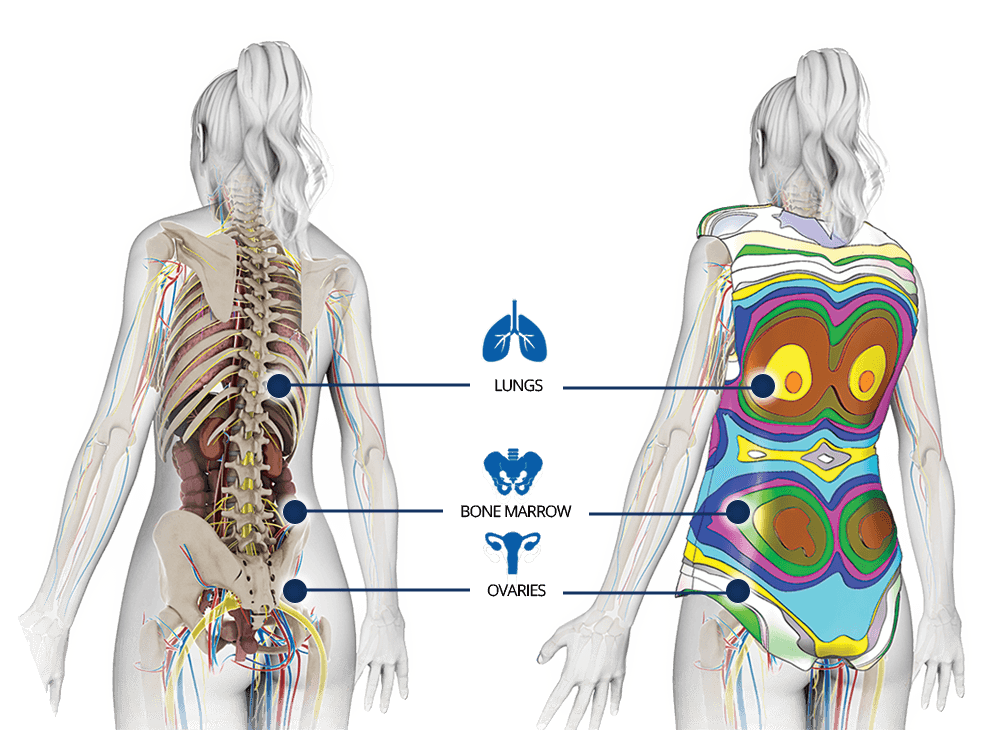 xray radiation